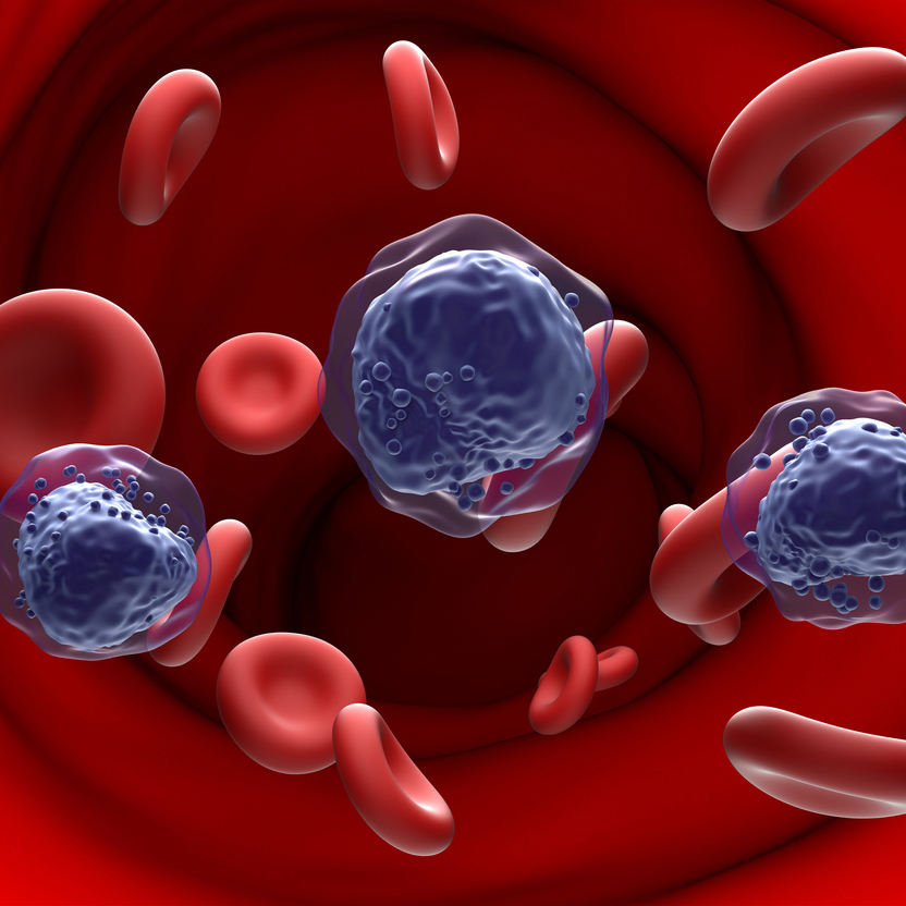 Acute myeloid leukemia (AML) cells